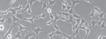 SARSTEDT標準表面上のHEK293細胞