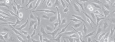 Células CHO en condiciones de suero reducido (1 %) en superficie SARSTEDT cell+